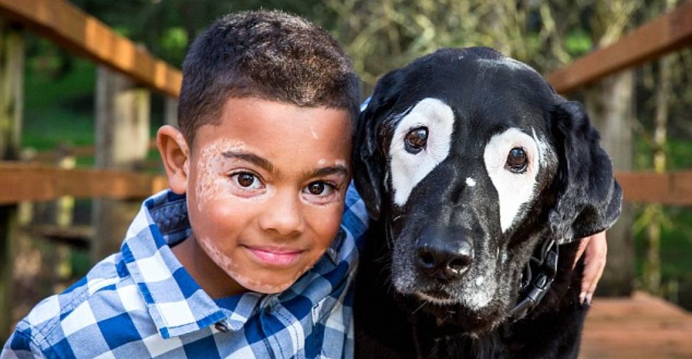 Era muy duro para él enfrentar su condición hasta que conoció un perro que le cambió la vida Era muy duro para él enfrentar su condición hasta que conoció un perro que le cambió la vida