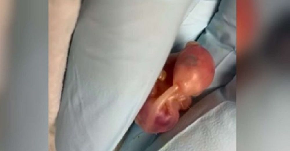 Tras perder a su mamá, esta diminuta recién nacida usa su cola como chupete para hallar consuelo